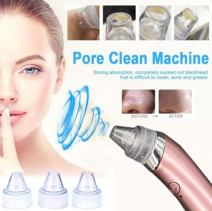 Blackhead Remover Acne Pore Cleaner Vacuum Usb Rechargeable (Color May Vary)