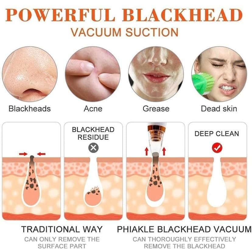 6 In 1 Rechargeable Electric Blackhead & Whitehead Remover Vacuum Pore Cleaner Facial Cleansing Tool view 5