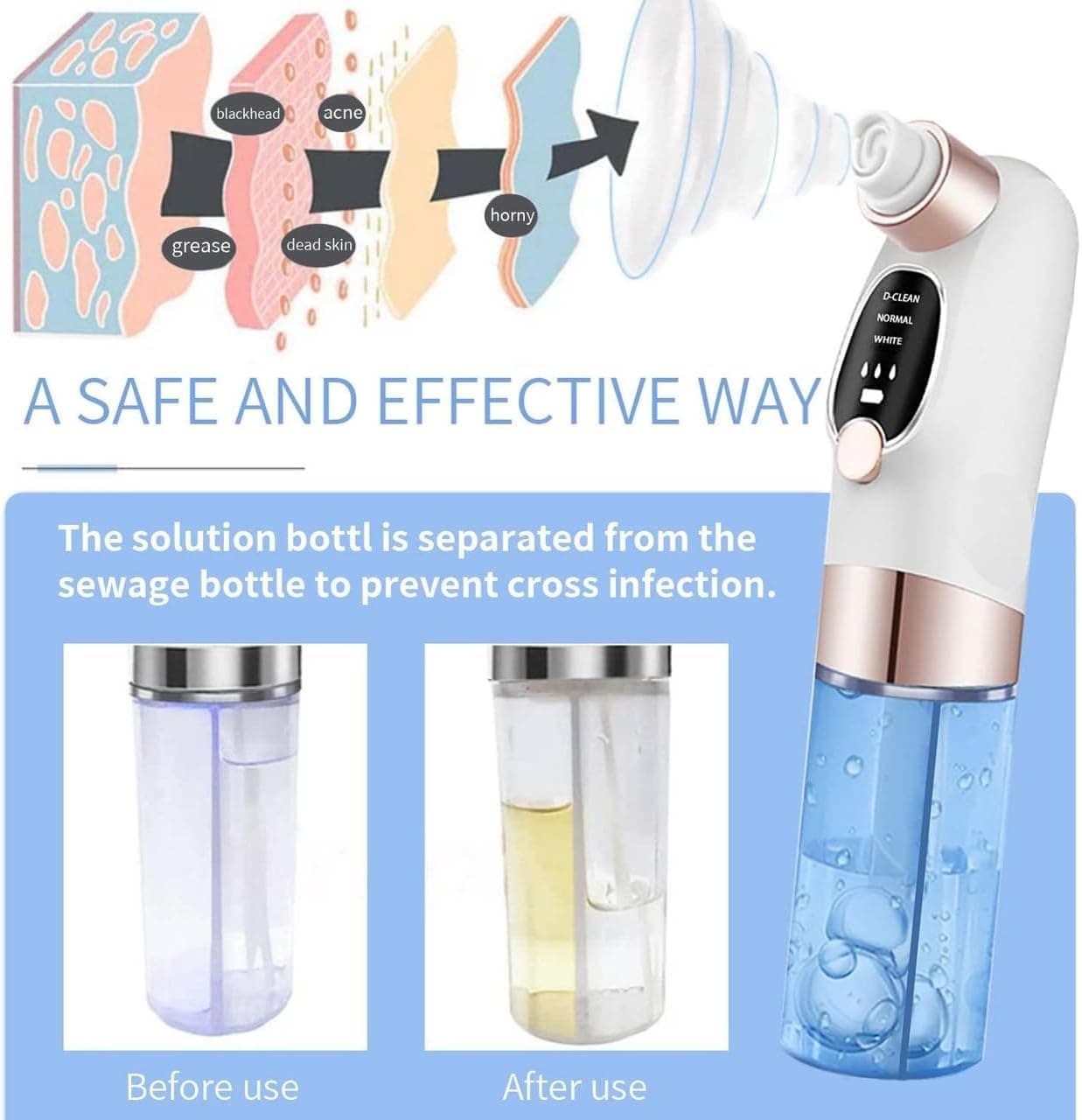 Electric Micro Bubble Blackhead Remover & Pore Vacuum Cleaner — image 2