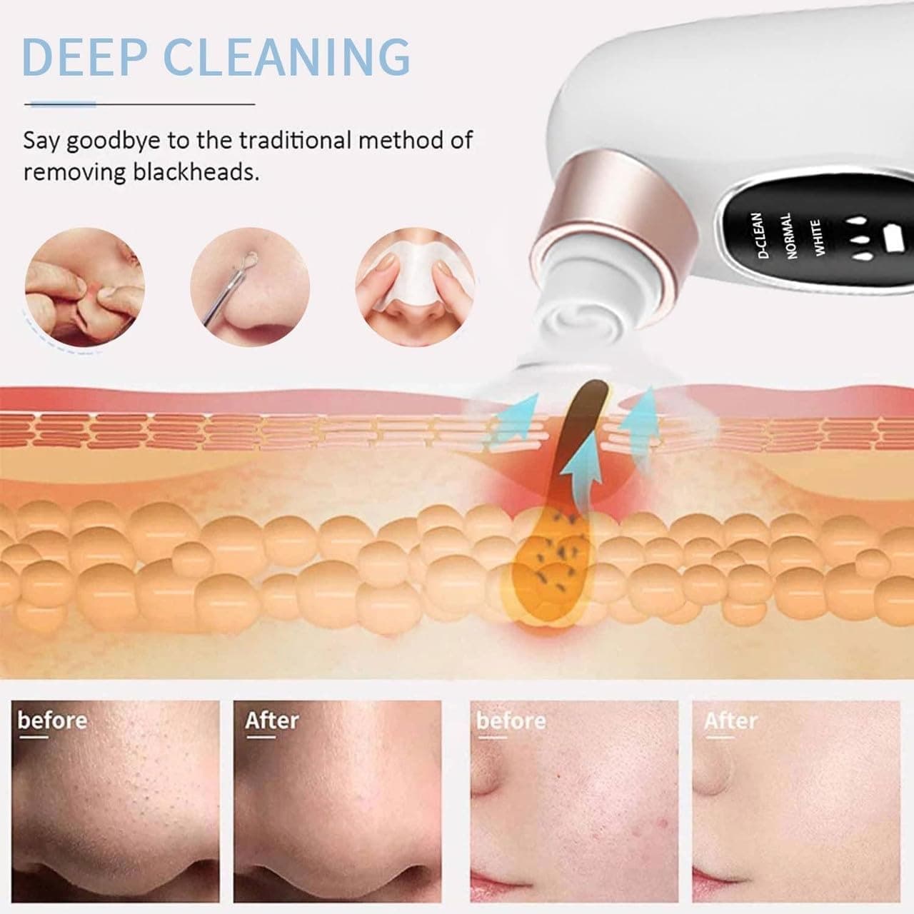 Electric Micro Bubble Blackhead Remover & Pore Vacuum Cleaner — image 4